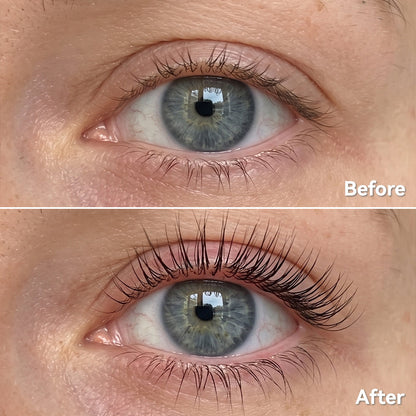 Essential Eyelash Growth Serum, Gentle Lashes Care, Fuller, Thicker in 2 Weeks, Non-Prostaglandin